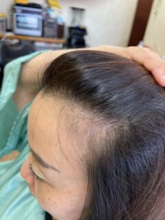 女性ホルモン減少で前髪が薄くなる!? 今日からできるケア法