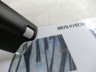 「清水の舞台」から飛び降りたけど…女性薄毛治療の現実